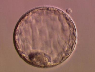 3. Grow embryo for 6 days in lab 4.