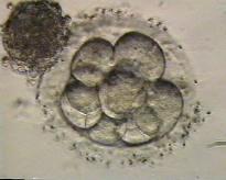 Therapeutic cloning is not reproductive cloning ES cells/embryo Reproductive cloning -> Implant into female (uterus)->-