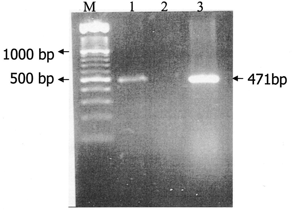 176 INDIAN J MED RES, FEBRUARY 2007 Fig. 1. PCR amplification of SHV gene, lane M: 100 bp ladder, Lane 1: K. pneumoniae clinical isolate, lane 2: E.coli ATCC25922 negative control, lane 3: K.