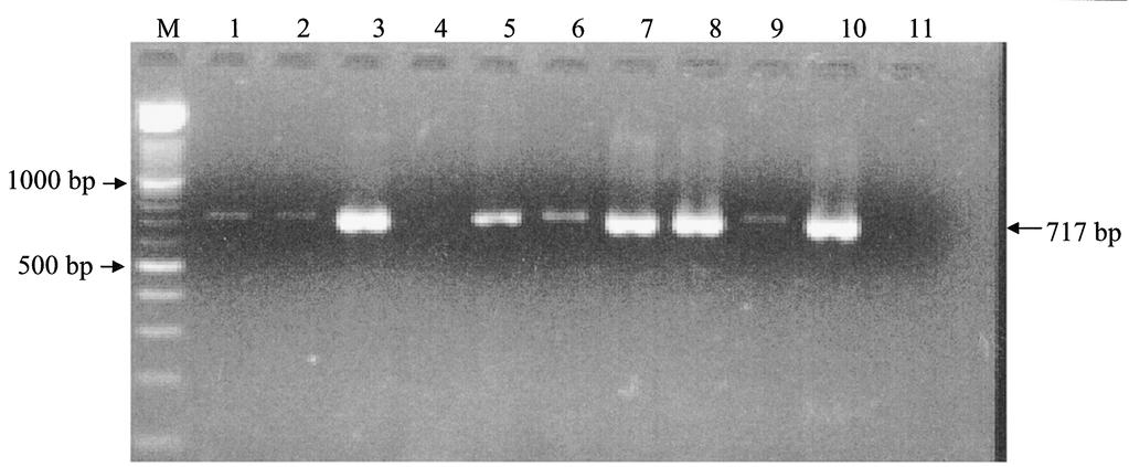 coli ATCC25922 negative control, lane 11: negative control (no template DNA added). presence SHV (Fig. 1) and TEM gene (Fig. 2).