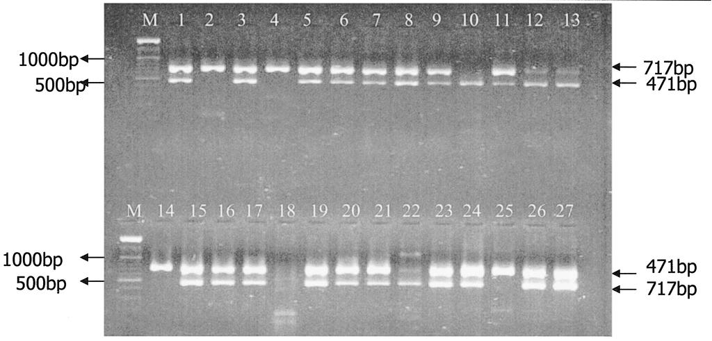 LAL et al: TEM & SHV GENE IN ESBLs PRODUCING KLEBSIELLA SP. 177 Fig. 3. Multiplex gene-specific PCR showing amplified product of TEM & SHV gene, Lane M: 100 bp ladder, lane 1-9, 11-17 & 1927: K.