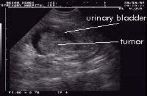 In an ultrasound exam, a transducer (probe) is placed directly on the skin or inside a body opening.