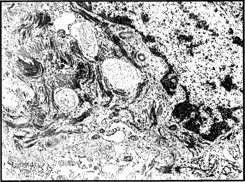 F our primary antibodies (Ab) were used for the first step o f the immunocytochemical study: 1. Anti-pan cytokeratin (mouse, Mo Ab; Cat. Nr. C 1801, Sigma Chemical Co.); 2.
