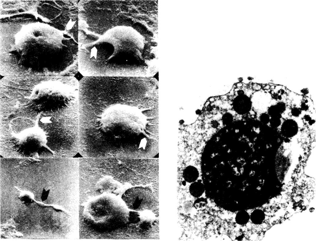 TEM micrographs (Fig.4) represented typical neutrophils with plenty of lipid and carbohydrate granules and often with activated nuclei.