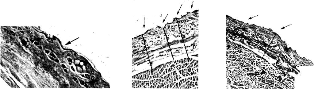 Fig. 1. Skin, subcutaneous adipose tissue (Sudan III) Fig. 2.