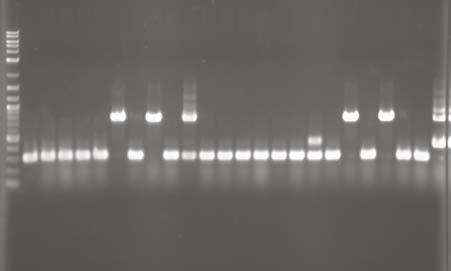 FastGene HotStart ReadyMix for the Direct PCR from Escherichia coli colonies The PCR products using the FastGene HotStart ReadyMix with loading dye resulted in a clearer electrophoresis pattern when