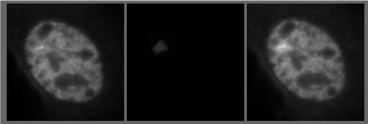The tandem array is visualized as a bright structure above the background of GFP-GR in the nucleus