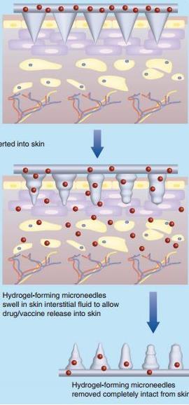 HYDROGEL-FORMING MICRONEEDLES Microneedles contain no drug