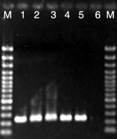 Mẫu được khuếch đại bằng RT-PCR một bước đến thể tích cuối cùng 25 μl chứa 5 μl RNA và 1 μl mỗi mồi external sử dụng QIAGEN OneStep RT-PCR kit. Chu trình nhiệt (1) 30 min. at 50 C, (2) 15 min.