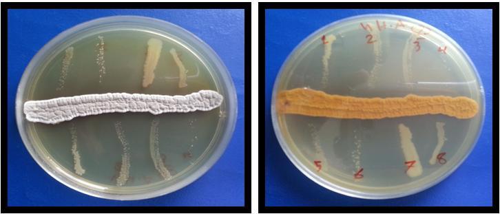 2. Escherichia coli. 3. Pseudomonas aeruginosa. 4. Serratiamarcescens. 5. Aeromonashydrophila. 6.