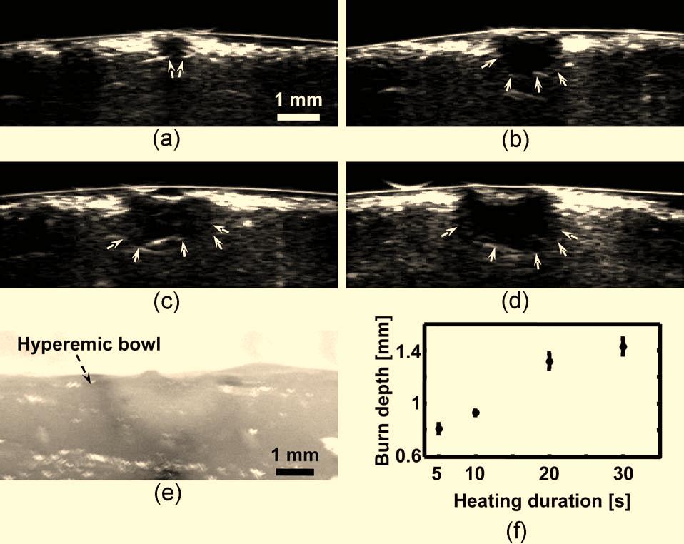 Fig. 3 PAM images of acute skin burns with different depths introduced by changing the heating durations to a 5, b 10, c 20, and d 30 s.