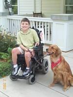 Duchenne Muscular Dystrophy CAUSE: (X linked