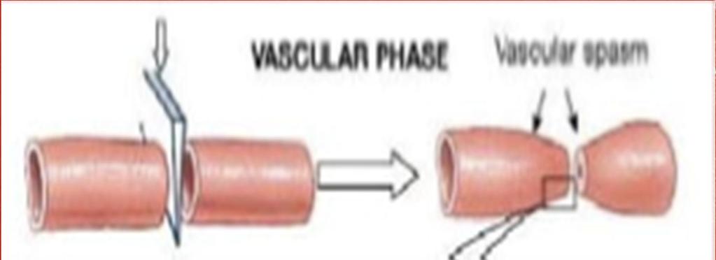 Vascular trauma Primary Haemostasis Vasoconstriction and exposure of subendothelium Platelet activation and adhesion to collagen Platelet shape change