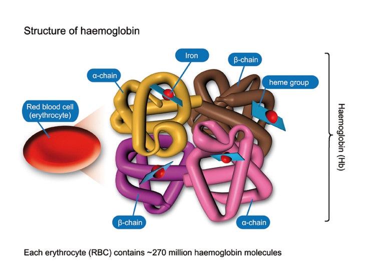 Haemoglobin Normal Haemoglobin Tetramer consisting of 4 globin chains, each