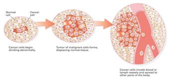 Angiogenesis: Telomerase: Metastasis: 1. Cancer is always genetic.