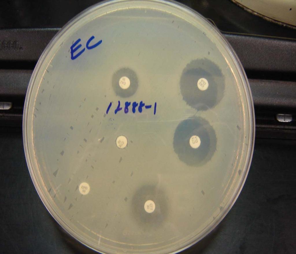 E. coli with