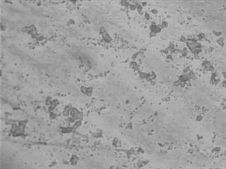 Vol.9, No.2 Effect of Precipitation Hardening 161 Plates 9. MIcrostructure of the Sample heated to 600 o C and held for 2 hour. Etch with 2% nital, magnification X400 Plates 10.