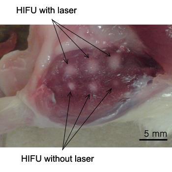 Figure 6.3 Photograph of HIFU lesions. HIFU treatments with laser and without laser were implemented in 5 mm depth from the skin.
