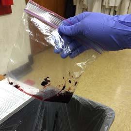 Cleaning up Bags of blackberry juice can go in the trash and any rinsing of juice in a cup can go down