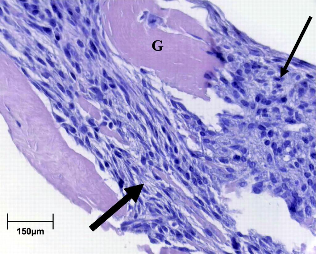 Figure 4.3 Histology of IAS rings. Histological cross section of bioengineered IAS ring stained with hematoxylin and eosin.