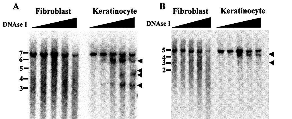Keratin K14 gene, analysis of the 5 -flanking region Digested with BglII+SpeI