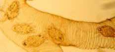 ceranae (microsporidia) Viruses Deformed Wing Virus (DWV) Israeli Acute Paralysis Virus (IAPV)