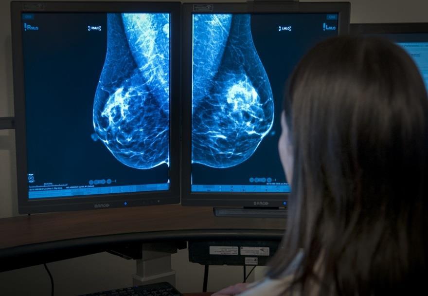 Challenge: Acquiring 3D Mammography Images Workstations cost $50,000 to $100,000 Dedicated