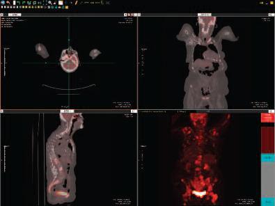 Challenge: Separate Workstations for Advanced Imaging Solution: Specialized Viewing Consolidated viewing for advanced imaging modalities including 3D Breast