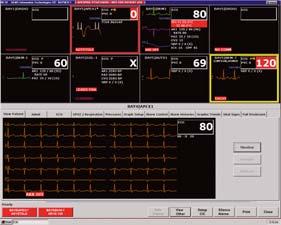 Measuring excellence, one heartbeat at a time. icentral CIC includes advanced clinical features that provide a clear and complete picture of a patient s status.