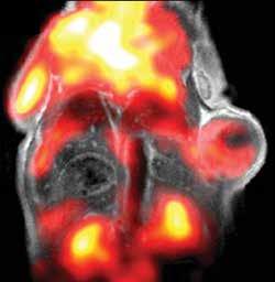 Once co-registered with the ICON MRI image, it is clear, that the signal comes from the gall bladder. PET PET/MRI MR/bioluminescence Imaging of Ovarian Cancer Tumor Model in Mouse Courtesy C.