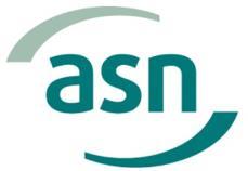 REPUBLIQUE FRANÇAISE ASN opinion 2017-AV-0298 of 10 October 2017 concerning the anomaly in the composition of the steel used for the Flamanville NPP EPR reactor pressure vessel lower head and closure
