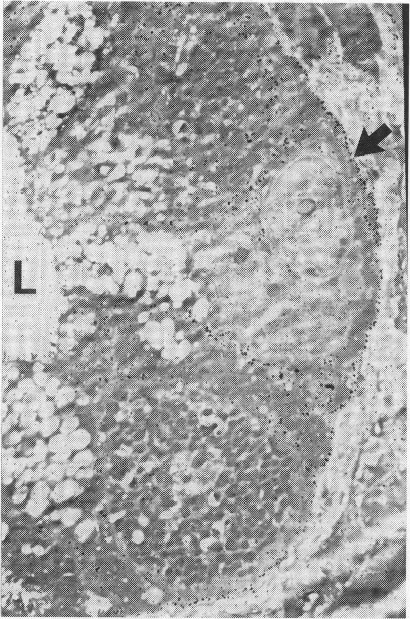 apical (luminal, L) membranes ofgastric glands. This is particularly well seen on the arrowed cell. Original magnification X6000.