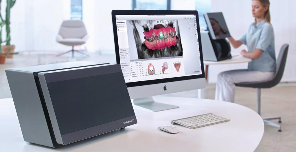 5 reasons to choose 3Shape Orthodontics Enhance analysis and treatment planning with fully