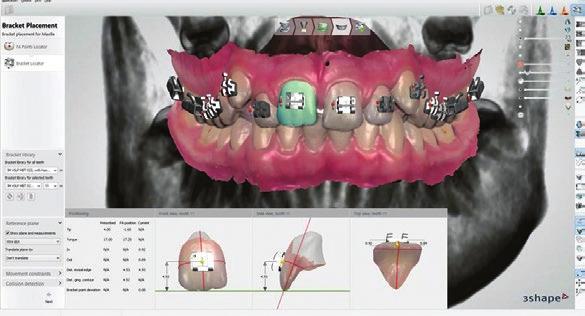 Orthodontic analysis services Take advantage of easy to use and customizable case analysis software.