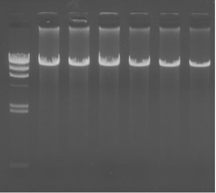 6. Purification of Genomic DNA from human whole blood and PCR amplification. Approximate 5 μg of highly purified genomic DNA was extracted from 1ml of human whole blood.