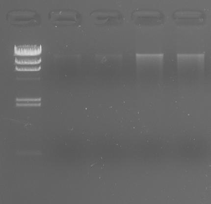 M 1 2 3 1% Agarose gel electrophoresis 1 : PCR product of human whole blood containing heparin anticoagulant genomic DNA 2 : PCR product of human whole blood containing Na2EDTA