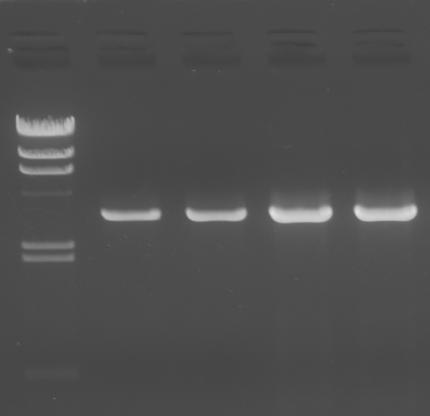 Electrophoresis of PCR fragment amplified using genomic DNA obtained 7.