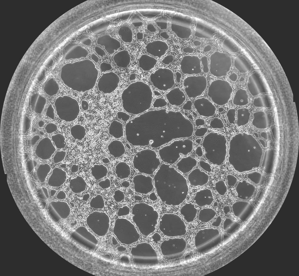 2. Material Cells: HUVEC (PromoCell, C-12200, C-12203) 10 4 per well Medium: Endothelial Cell Growth Medium (PromoCell, C-22010) 50 µl per well Gel matrix: Matrigel Growth Factor Reduced, Phenol