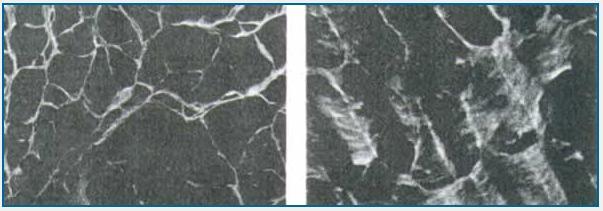 oval-shaped or elongated, with the ovals pointing towards the origin of fracture (Figure 3 right).