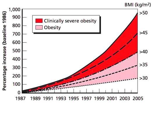 Obesity Trend-lines Obesity Trends* Among U.S.