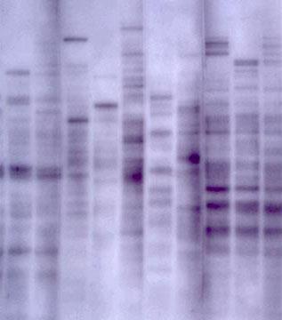 DNA Fingerprinting Determining the sequence of bases in DNA for comparisons How
