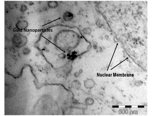 Nanoparticles enter cell cytoplasm.