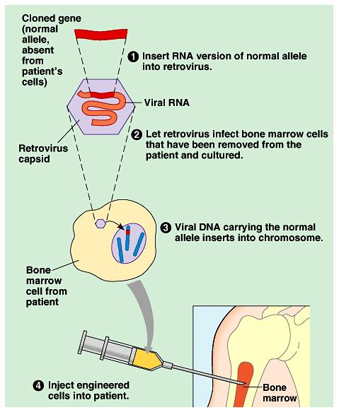 Bone marrow cells, which include stem cells that give rise to blood and immune system cells, are prime candidates for gene therapy.