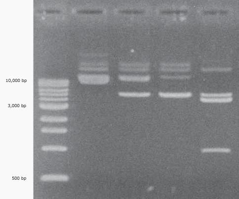 Restriction digest of plasmid DNA from Escherichia coli, run on a 1% agarose gel and stained with ethidium bromide.