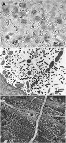Anaerobic Flagellates Prokaryotes in the periphery