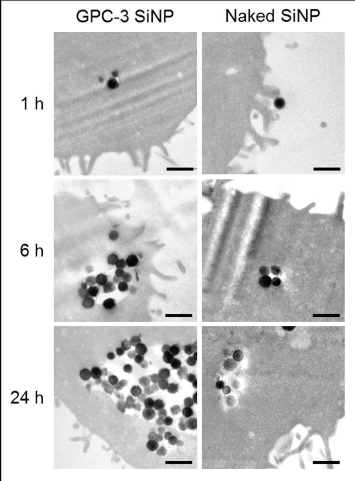 Figure S6. TEM analysis of HepG2 cells treated with SiNPs.