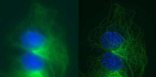 Out-of-focus blur Focal plane 1 2 d z A cell with stained DNA (blue) and microtubules (green) Cell is illuminated with excitation light from below: Positions 1 and 2 at different heights in the