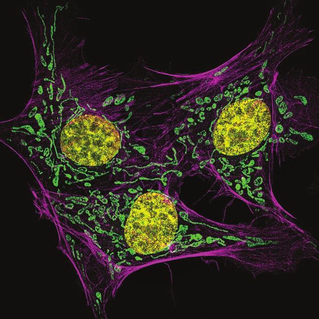 M. Kandasamy, stained cells: actin (pink), DNA (yellow),