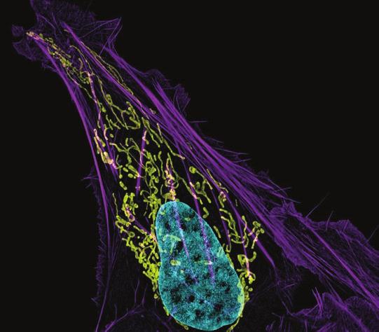 D. Burnette, osteosarcoma cell (bone cancer) showing actin (purple),