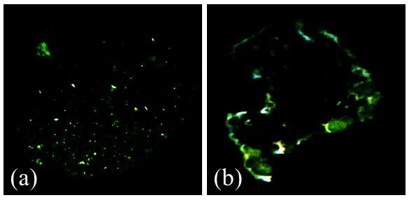 A thin layer imaging with the Total Internal Reflection Fluorescence Microscopy * 53